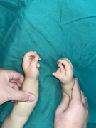 Three thumbs on the right hand—the shape they formed is bey